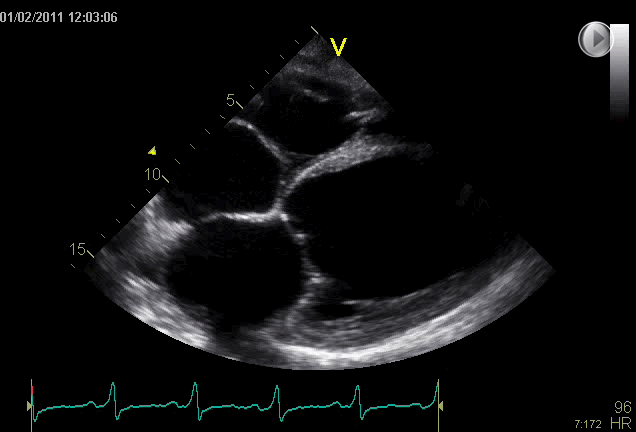 EEU case image missing